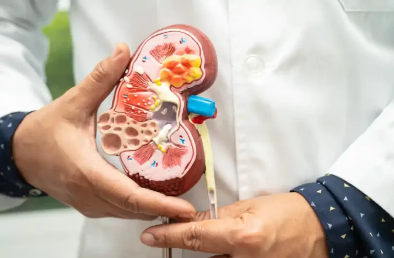 Model lidské ledviny v rukou lékaře